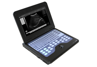 CMS600P2 B-Ultrasound Diagnostic System